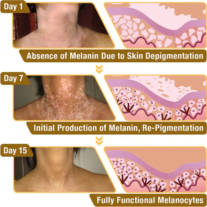 NEW Revitalizing Bee Venom Cream – Natural Skin Restoration & Vitality (Buy 1 Get 1 Free🔥)
