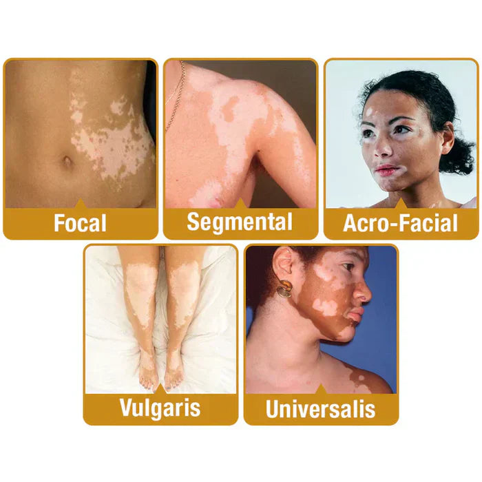 NEW Revitalizing Bee Venom Cream – Natural Skin Restoration & Vitality (Buy 1 Get 1 Free🔥)
